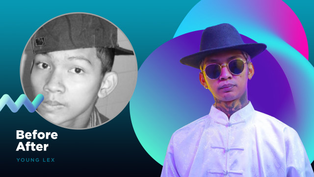 Before-After Young Lex Foto: Sabryna Putri Muviola/kumparan