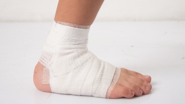 Ilustrasi patah tulang pada anak balita Foto: Shutterstock