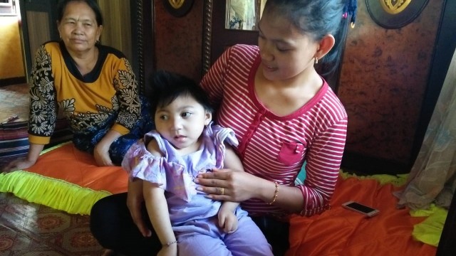 Aulia (5,5) didiagnosa mengidap mikrosefali. Foto: Suwandi