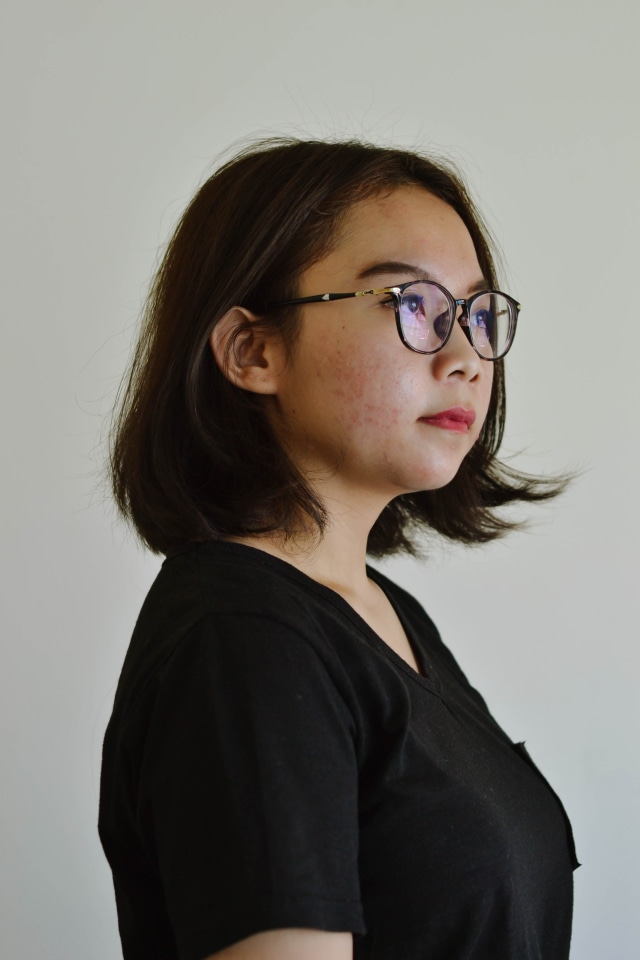 Ilustrasi Bekas Jerawat. Foto: dok. Unsplash/Audrey Jackson