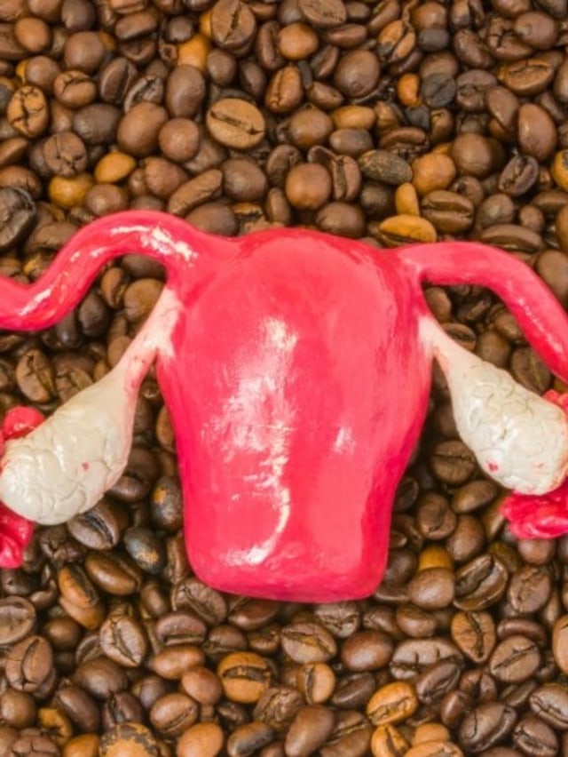 Ilustrasi PCOS pada wanita Foto: Shutterstock