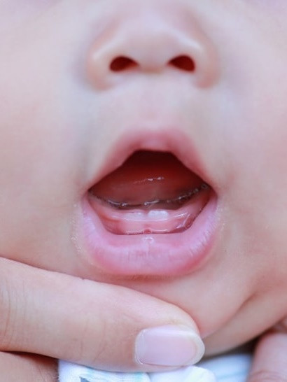 Penyebab Bayi Terlambat Tumbuh Gigi. Foto: Shutterstock