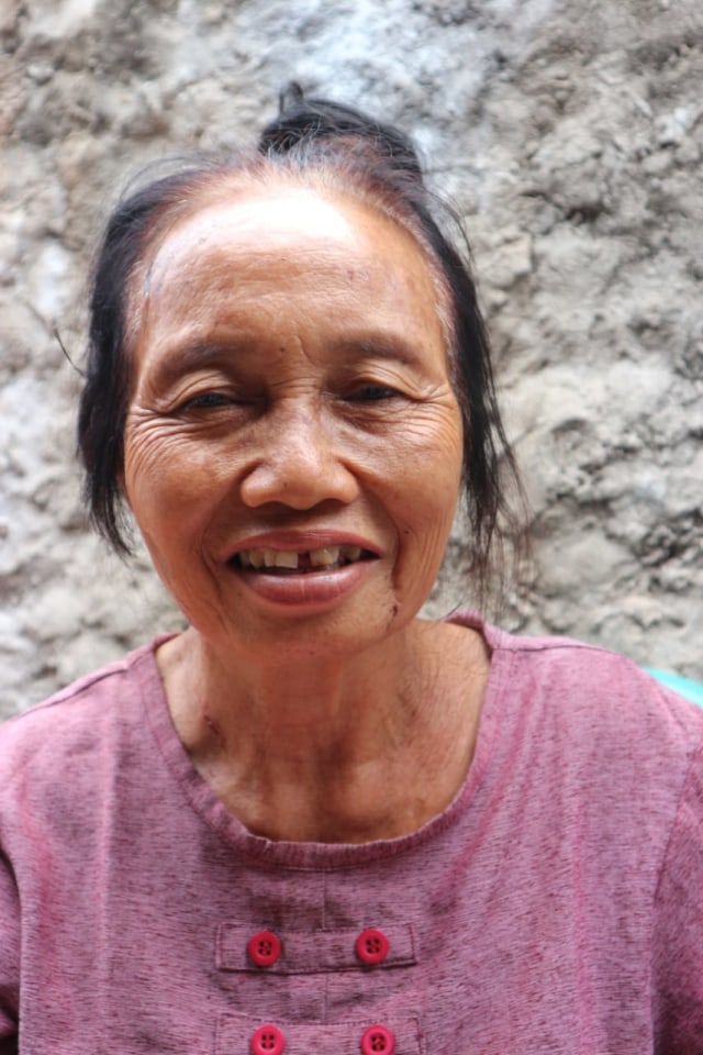 Sakinah, tukang sayur korban penyiraman air keras. Foto: Ulfa Rahayu/kumparan