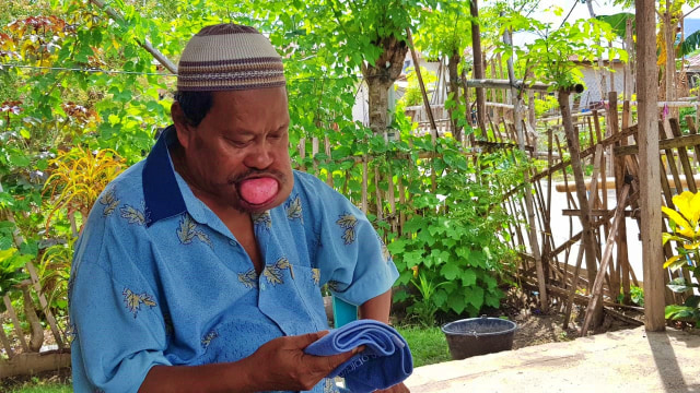 Saiful Kasim, warga Desa Ilotidea, Kecamatan Tilango, Kabupaten Gorontalo, menderita tumor jinak dibagian rahang. Kamis, (5/12) Foto : Dok Banthayo.id (Burdu)