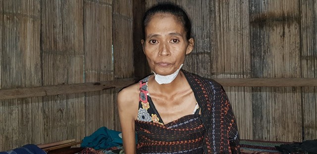 Mama Maria Ursula, penderita tumor lidah yang menjalani operasi pengambilan jaringan lunak di leher di RSUD TC.Hilers Maumere. Foto: Mario WP Sina 
