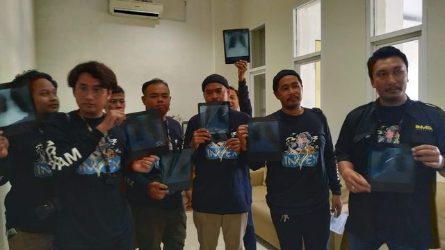 Pengguna rokok elektrik melakukan ronsen atau rontgen paru paru bersama. foto: atx