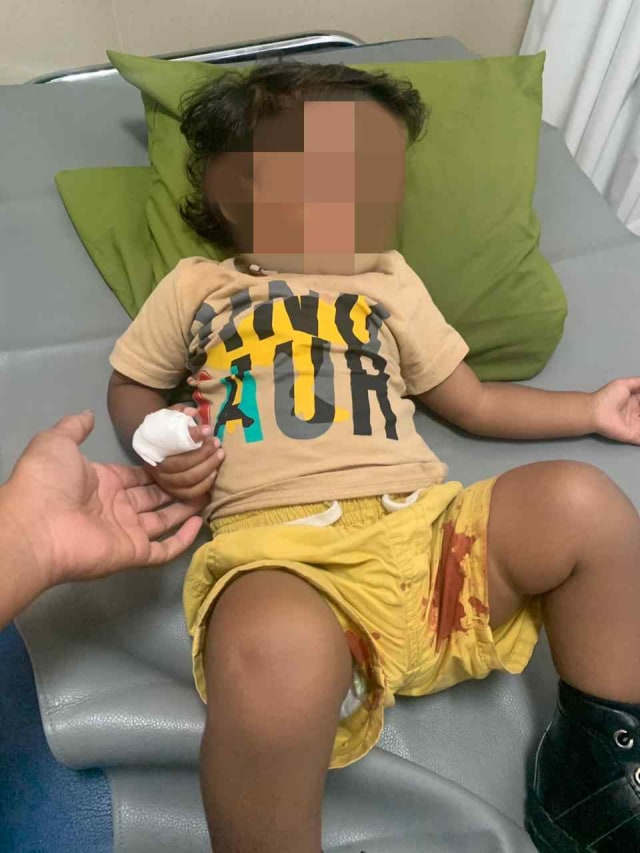 Bocah diduga digigit ikan aligator di lapas sukamiskin Bandung. Foto: Dok. Istimewa