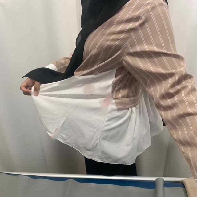 Bercak darah di baju orang tua bocah yang diduga digigit ikan aligator di lapas sukamiskin Bandung. Foto: Dok. Istimewa