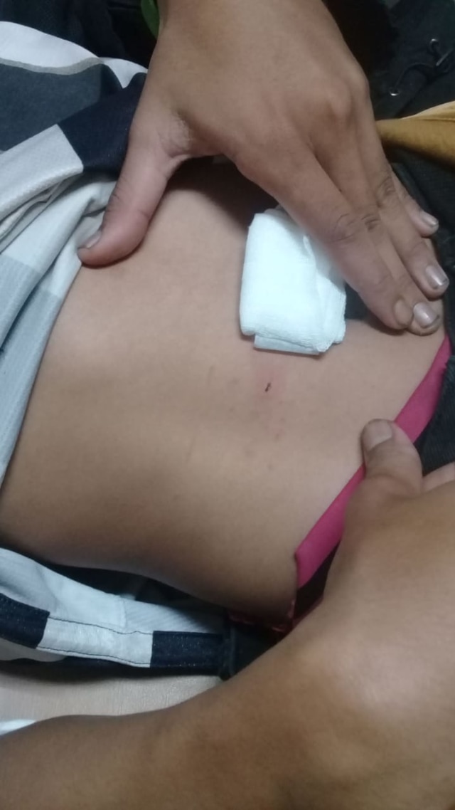 Sopir ojol yang diduga ditusuk, di Bandung. Foto: Dok. Istimewa