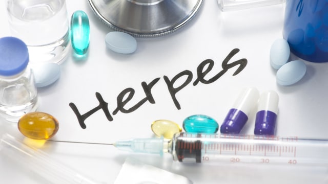Ilustrasi herpes. Foto: Shutter Stock