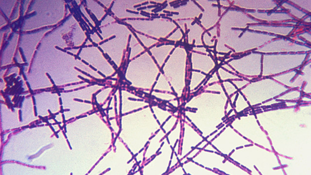 Bacillus anthracis, bakteri penyebab antraks Foto: CDC via Wikimedia Commons