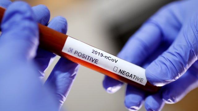 Petugas menunjukan tabung reaksi dengan label nama virus Corona. Foto: REUTERS / Dado Ruvic