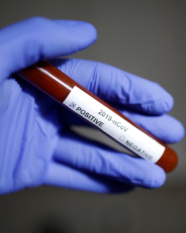 Petugas menunjukan tabung reaksi dengan label nama virus Corona. Foto: REUTERS / Dado Ruvic