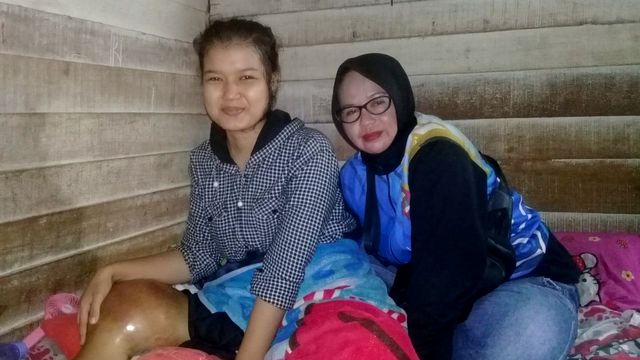 Riska Rahmadila, atlet voli penderita tumor, dan Foto: Dok. Ai Suryati