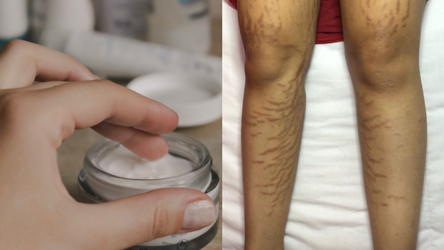 Ilustrasi Lotion doc Unsplash