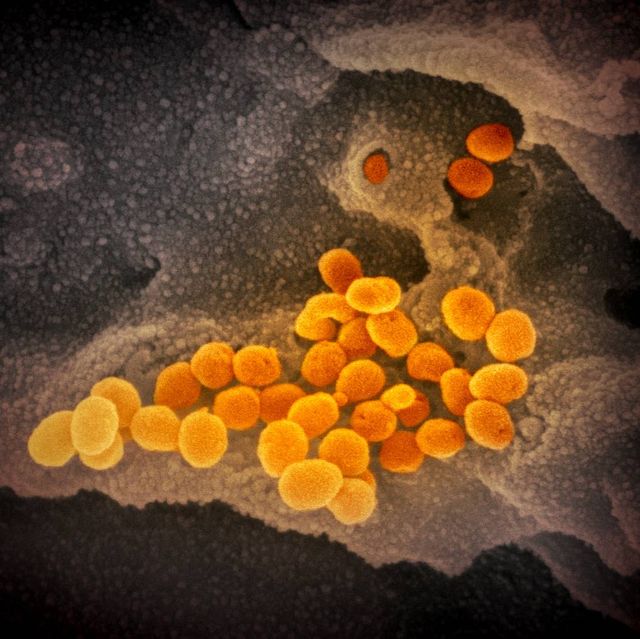 Wujud asli virus corona SARS-CoV-2 yang terlihat melalui mikroskop. Foto: National Institute of Allergy and Infectious Diseases via flickr (CC BY 2.0)