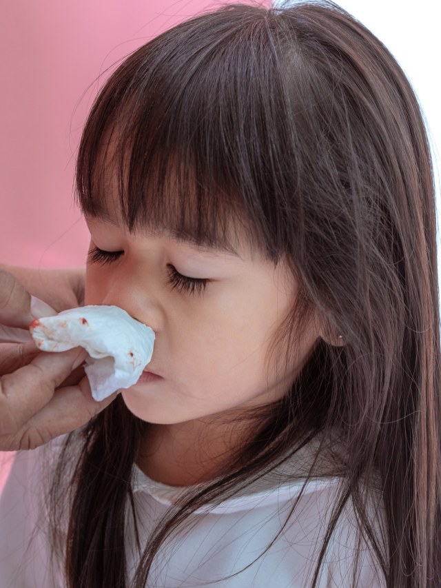 Ilustrasi mimisan pada anak. Foto: Shutter Stock 