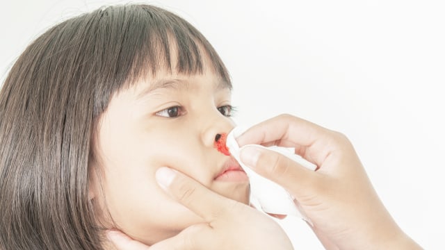 Ilustrasi mimisan pada anak. Foto: Shutter Stock 