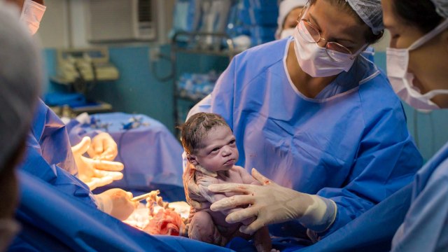 Ekspresi bayi lucu di Brazil. Foto: Facebook/Rodrigo Kunstmann