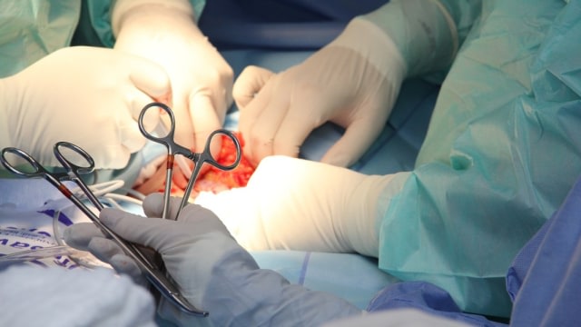 Ilustrasi persalinan caesar Foto: Pixabay