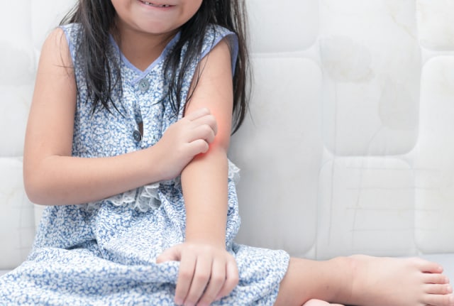 Ilustrasi anak alergi Foto: shutterstock