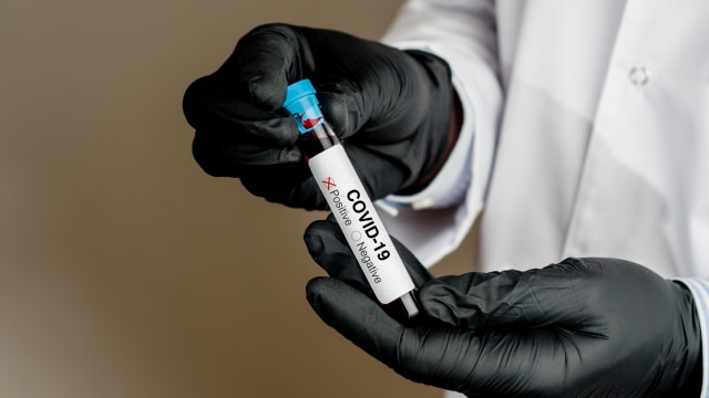 Ilustrasi positif terkena virus corona. Foto: Shutter Stock