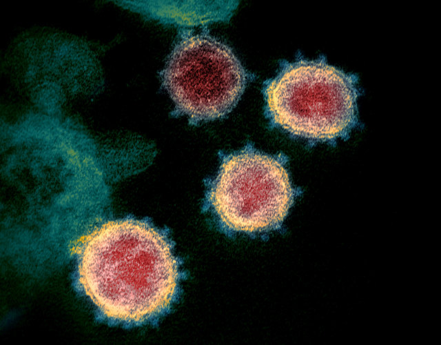 Sebuah mikrograf elektron transmisi yang tidak bertanggal dari partikel virus SARS-CoV-2 yang diambil dari pasien yang diisolasi di Amerika Serikat. Foto: NIAID Integrated Research Facility (IRF) via REUTERS