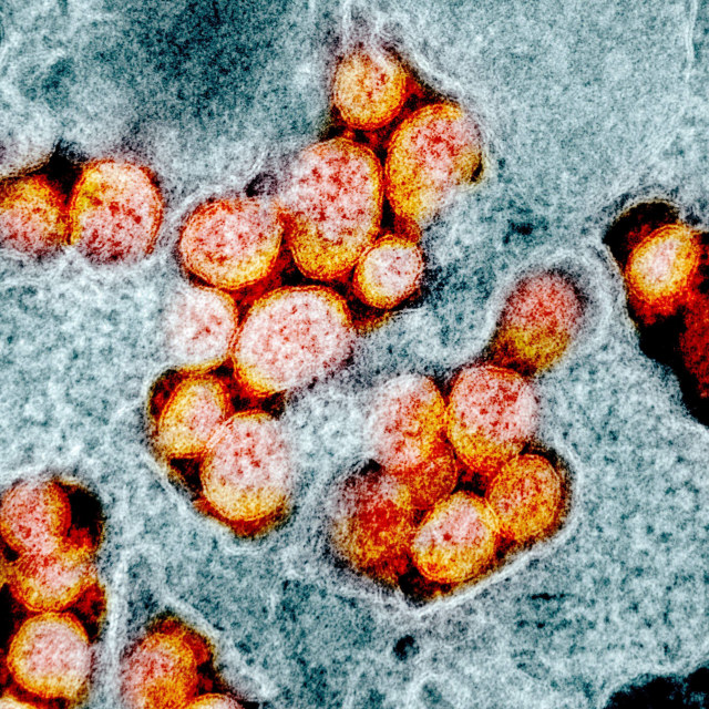 Sebuah mikrograf elektron transmisi yang tidak bertanggal dari partikel virus SARS-CoV-2 yang diambil dari pasien yang diisolasi di Amerika Serikat. Foto: NIAID Integrated Research Facility (IRF) via REUTERS