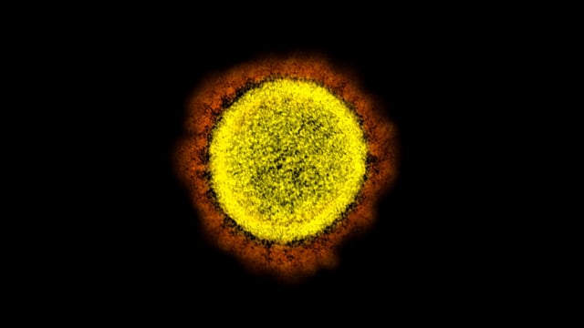 Partikel virus SARS-CoV-2. Foto: NIAID Integrated Research Facility (IRF) via REUTERS