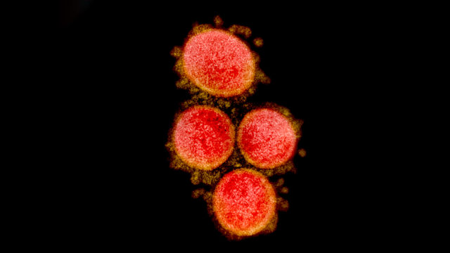 Partikel virus SARS-CoV-2. Foto: NIAID Integrated Research Facility (IRF) via REUTERS