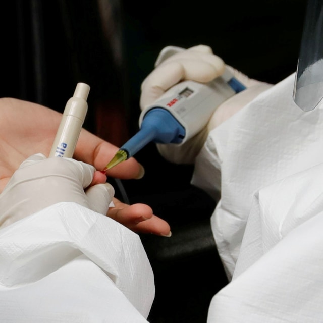Tes virus corona. Foto: REUTERS/Willy Kurniawan