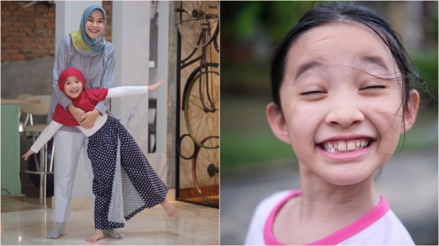 Sybil, anak Zaskia Adya Mecca punya gigi kelinci. Foto: IG @kana.sybilla @zaskiadyamecca