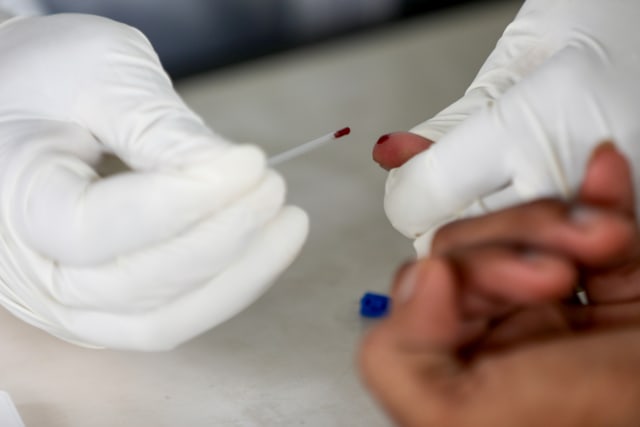 Mengambil sampel darah untuk pemeriksaan rapid test corona di Puskesmas Montasik, Aceh Besar. Foto: Suparta/acehkini