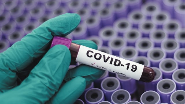 Ilustrasi positif terkena virus corona. Foto: Shutter Stock
