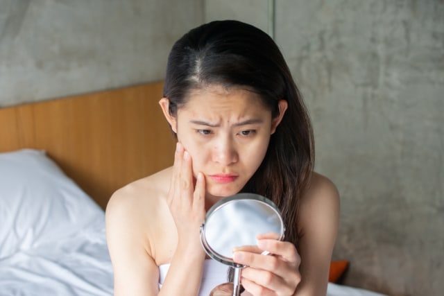 Cara merawat kulit sensitif agar tidak cepat iritasi. Foto: Shutterstock