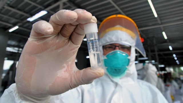 Petugas medis menunjukkan hasil sampel saat tes swab di Stasiun Bogor, Jawa Barat. Foto: ANTARA FOTO/Arif Firmansyah