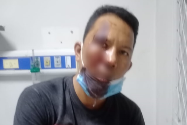 Driver taksi online di Bogor yang diduga dihajar oknum polisi. Foto: Dok. Istimewa