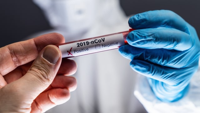 Ilustrasi rapid test. Foto: Shutterstock