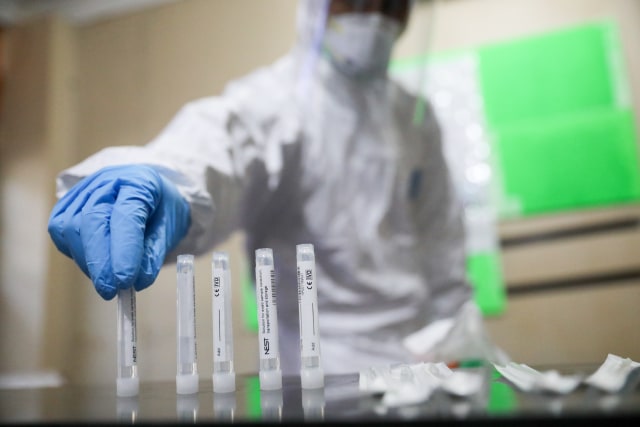 Pemeriksaan tes swab gratis di Posko COVID-19 Kota Banda Aceh, Kamis (4/6). Foto: Suparta/acehkini 