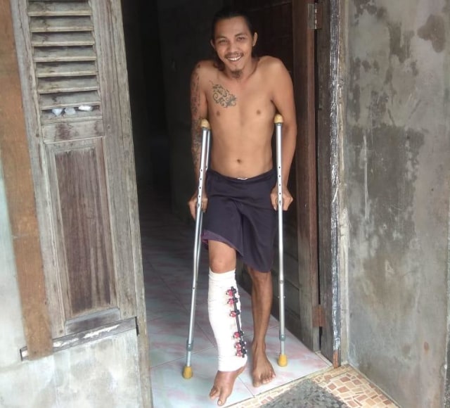 Petrus yang mengalami patah kaki. Foto: Dok Hi!Pontianak