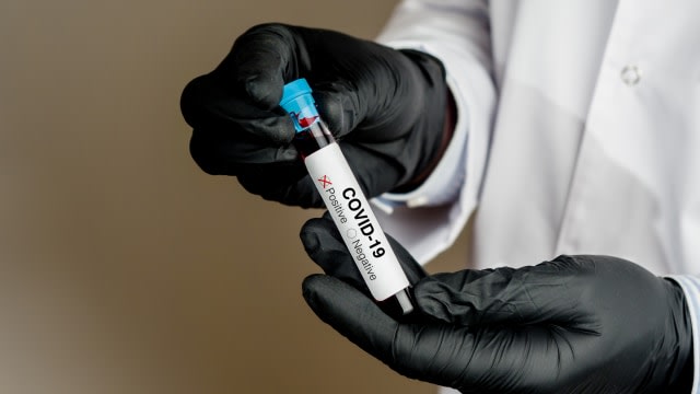 Ilustrasi positif terkena virus corona. Foto: Shutter Stock