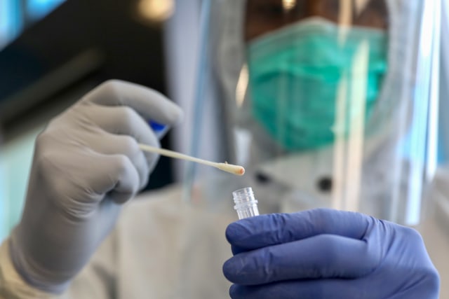 Ilustrasi sampel swap. Foto: Suparta/acehkini