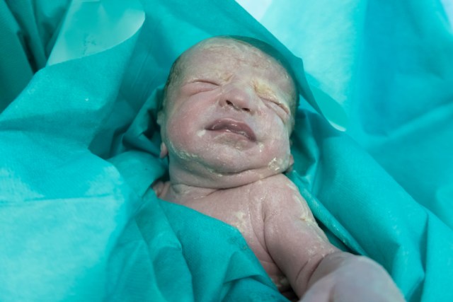 Vernix atau lapisan putih pada bayi baru lahir.  Foto: Shutterstock