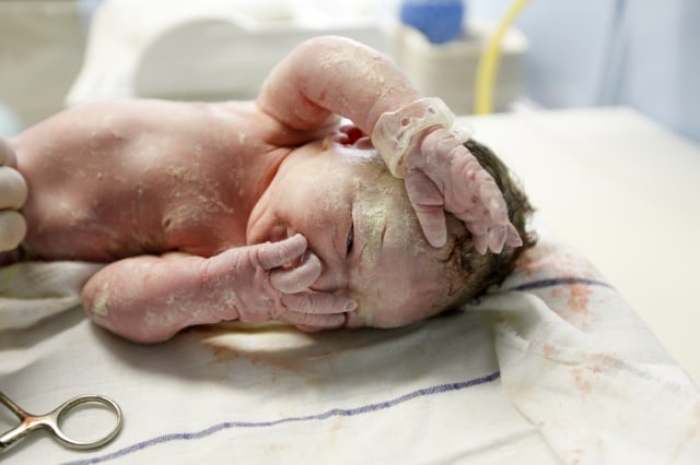 Vernix atau lapisan putih pada bayi baru lahir.  Foto: Shutterstock