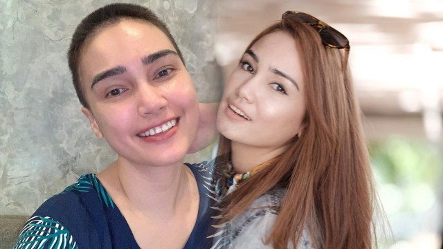 Feby Febiola sesudah dan sebelum botak. Foto: Instagram/Feby Febiola