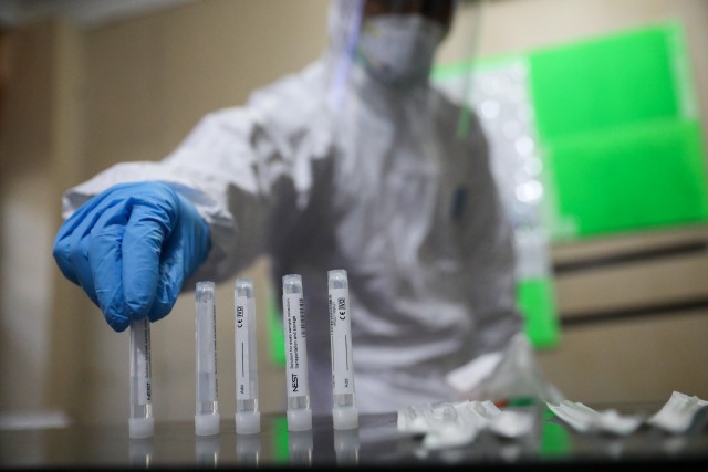 Petugas medis di Aceh melakukan pemeriksaan sampel swab COVID-19. Foto: Suparta/acehkini