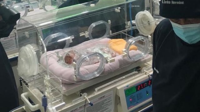 Bayi di Batam yang lahir menderita penyakit kulit langka di dunia yang dirawat di RS Graha Hermine, Batam. Foto: Zalfirega/kepripedia.com