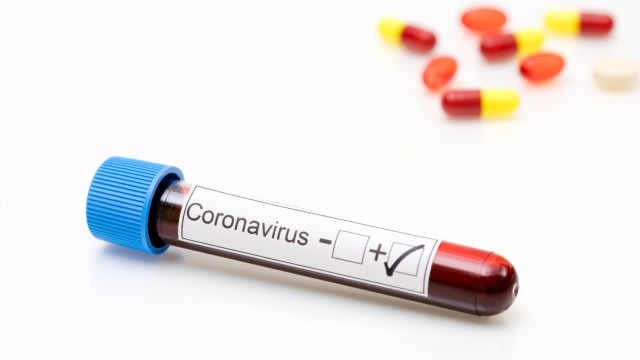 Ilustrasi positif terkena virus corona. Foto: Shutter Stock