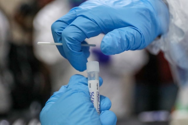 Sampel swab yang telah diambil dari seorang warga yang menjalani tes swab massal gratis. Foto: Suparta/acehkini