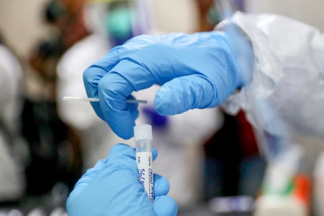 Ilustrasi sampel swab. Foto: Suparta/acehkini
